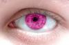 eye pink